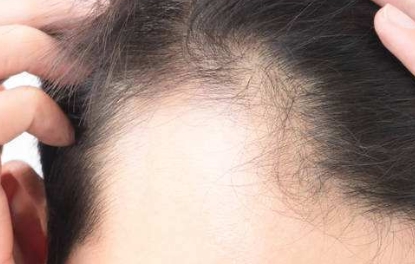 國內(nèi)頂級面部脂肪填充醫(yī)院盤點：頂尖專業(yè)團隊，選擇一定不后悔！