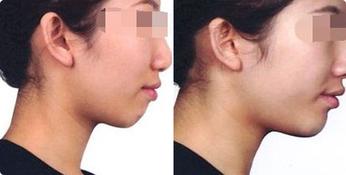 呼和浩特五家頂級整容醫(yī)院曝光，追求美麗的人士必看！