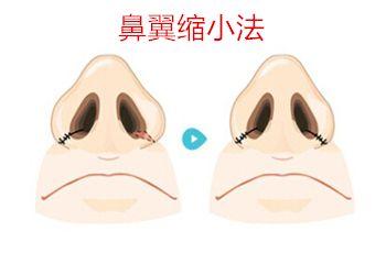 天津疤痕治療醫(yī)院推薦！這5家專業(yè)醫(yī)院排名前列！