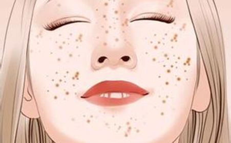 中山超微重瞼術雙眼皮醫(yī)生