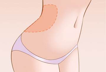 呼市哪家醫(yī)院最受歡迎？雙眼皮效果超過80%的用戶推薦！