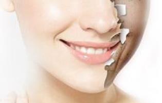 浙江手術去除靜態(tài)紋醫(yī)生