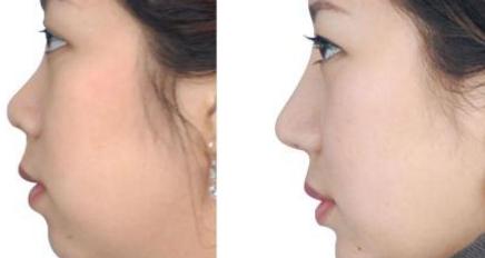 國內十佳疤痕治療醫(yī)院評選結果曝光：公立醫(yī)院對私立醫(yī)院PK！