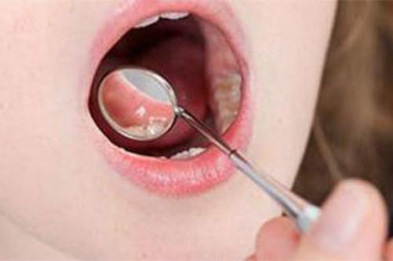 青島面部埋線提拉術醫(yī)生