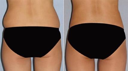 成都最受好評的整形醫(yī)院匯總，專業(yè)拉皮手術(shù)效果一流