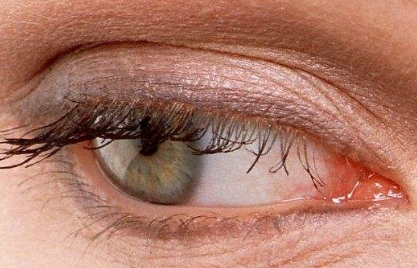 杭州哪家眼部整形醫(yī)院比較靠譜？浙江雙眼皮整形醫(yī)院排行榜TOP7！