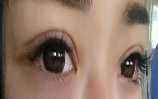 張家口市隆胸整形醫(yī)院排行榜：性價比之選一定適合你