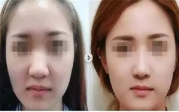 杭州最受歡迎的整形醫(yī)院推薦！匯總市場口碑最好的八家醫(yī)美機構(gòu)，綜合評價超乎想象，專業(yè)水平極高！