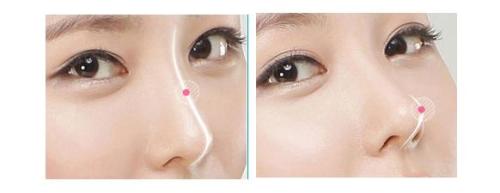 揭秘西安豐胸三甲醫(yī)院專家評(píng)選！西京、唐都脫穎而出，實(shí)力堪比五強(qiáng)！