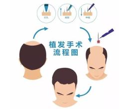 昆明哪家隆鼻醫(yī)院比較靠譜？【10所信譽(yù)極高的醫(yī)療機(jī)構(gòu)】