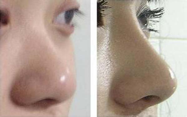 杭州口碑最佳的整形醫(yī)院盤點！匯總七家頂級醫(yī)療機構(gòu)，專注為您帶來品質(zhì)醫(yī)美服務(wù)