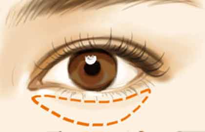 懷化哪家醫(yī)院做臉部脂肪填充效果好？2023年價目表全知道，去評價最好的六家吧！