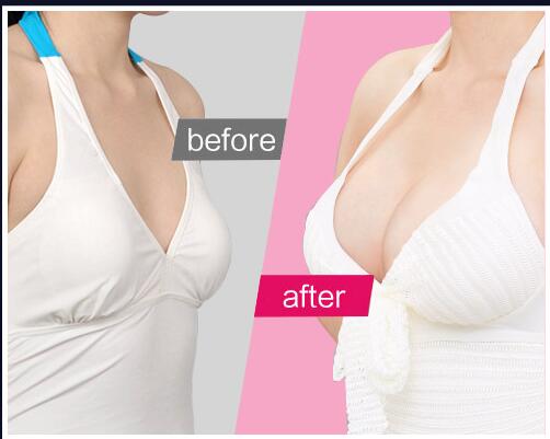 惠州市的頂尖整容整形醫(yī)院排行榜發(fā)布，時(shí)光演變伊麗莎白變得更加耀眼了！