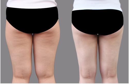 廣西整形醫(yī)院精選！當(dāng)紅top6醫(yī)院名單曝光，人氣首選聚焦簡介