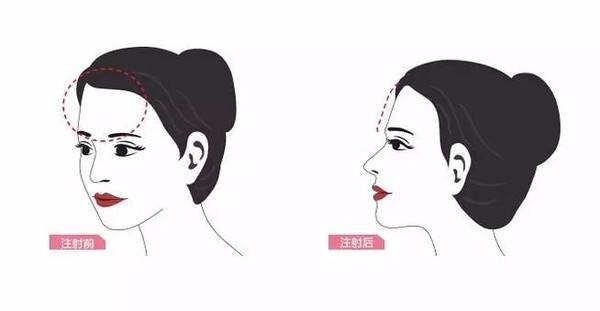 成都哪些醫(yī)院可進行磨骨手術(shù)【三家鑒定】