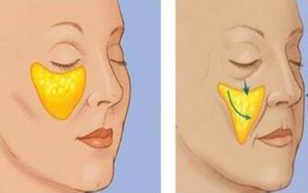 揭秘四川地區(qū)優(yōu)質(zhì)隆鼻醫(yī)院Top4，大多為公立醫(yī)療機(jī)構(gòu)！