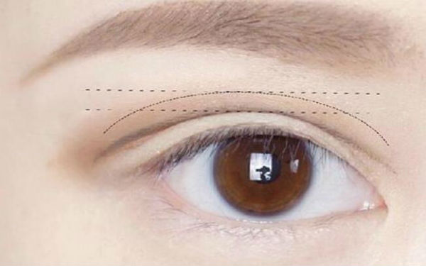 振華醫(yī)院、白求恩醫(yī)院、芳草地美容醫(yī)院哪家適合做沈陽(yáng)吸脂手術(shù)？選擇這些受歡迎的美容醫(yī)院，可信賴(lài)！