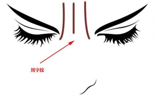 成都雙眼皮修復(fù)手術(shù)：五家性價(jià)比高、技術(shù)好的醫(yī)院推薦