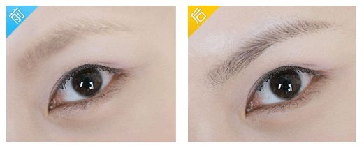 浙江哪個地方可以有效治療疤痕？優(yōu)質(zhì)機構(gòu)入圍省內(nèi)六地8家！