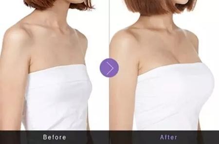 沈陽磨骨瘦臉五大頂級技術(shù)推薦，這幾家技術(shù)最受關(guān)注！