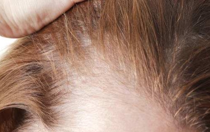 洛陽(yáng)最受歡迎的雙眼皮整形醫(yī)院排行榜！預(yù)算驚喜！