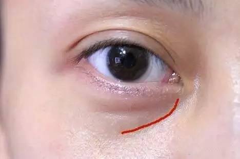 沈陽哪家醫(yī)院做雙眼皮好？推薦這幾家，讓你的雙眼美麗動人起來！