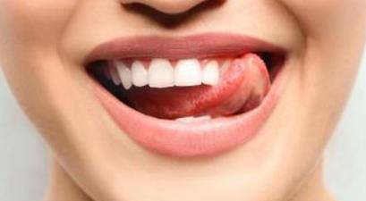 紹興botox瘦臉針圖醫(yī)生