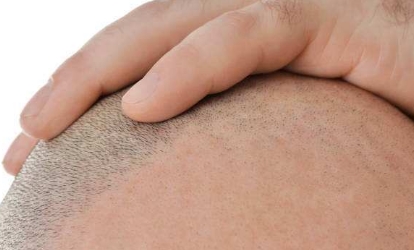 深圳最熱門的拉皮手術(shù)醫(yī)生推薦！值得信賴的十大醫(yī)師名單發(fā)布！