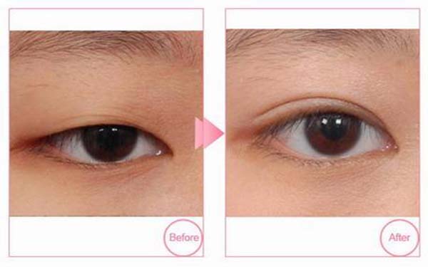 武漢地區(qū)牙科醫(yī)院羅列【口腔機構(gòu)4家】