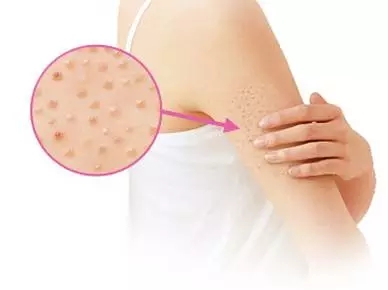 浙江哪家整形醫(yī)院最受歡迎？浙江前五強推薦！