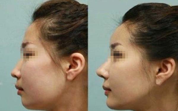 深圳頂級整容醫(yī)院排行榜發(fā)布！整形美容醫(yī)院報價明細表最新更新