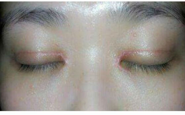 沈陽超贊的私密緊致術(shù)醫(yī)院匯總排名前十，曙光、美萊技術(shù)對比分析，各有獨特魅力！