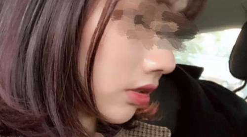 煙臺(tái)雙眼皮整形醫(yī)院排名前五名揭曉！用戶口碑持續(xù)贊賞