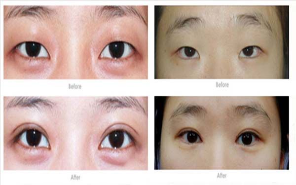 淮安有哪些口碑很好的整形醫(yī)院？前五排名來了！