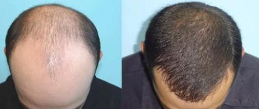 深圳哪家公立整形醫(yī)院好？本地人廣受推崇的前六名推薦