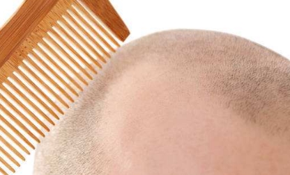 滄州市哪家醫(yī)院的隆鼻整形技術(shù)最實(shí)力？排行榜公布！