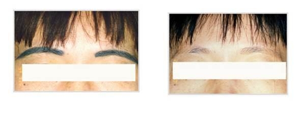 沈陽七家拉皮手術(shù)一流，用戶評價方法巧妙