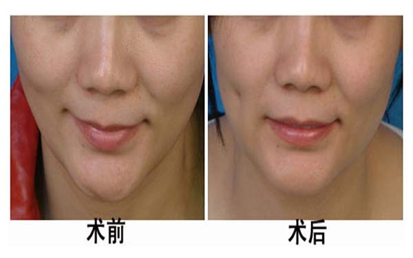 溫州整形行業(yè)揭秘！頂級醫(yī)院曝光，藝星、星范露真面目，領(lǐng)先三家！