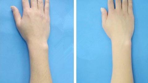 泰安斑點(diǎn)治療醫(yī)院排行榜：選擇這些醫(yī)院，讓斑點(diǎn)不再遮擋你的美麗~