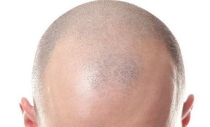 汕頭2023年微創(chuàng)整形醫(yī)院好評(píng)榜單前六名：伊麗莎白、華美、曙光脫穎而出！