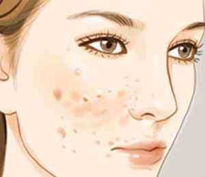 煙臺市內著名雙眼皮整形醫(yī)院推薦【5所醫(yī)院】