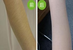 武漢頂尖整形醫(yī)院盤點(diǎn)：協(xié)和、美立方、壹加壹等脫穎而出！是否心儀醫(yī)院榜上有名？速來(lái)一探究竟！