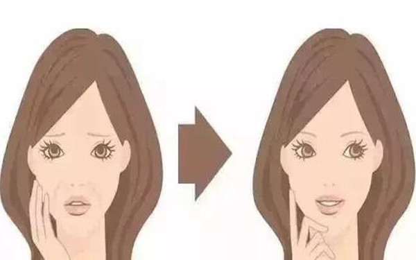 福州整形醫(yī)院排行榜：臺江、比華利、海峽、名韓、美萊華美五大推薦！挑選合適的整形醫(yī)院更輕松！