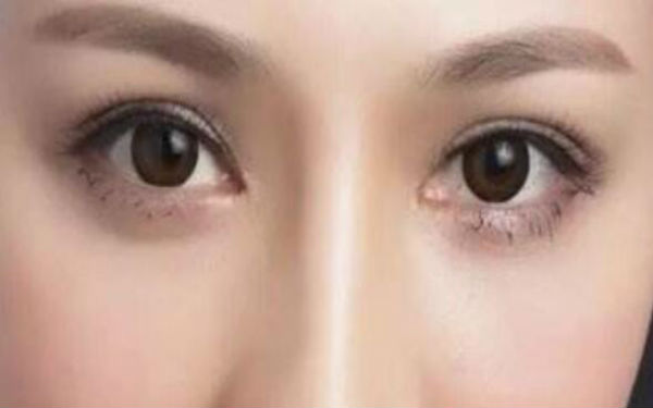 邯鄲割雙眼皮醫(yī)院排行榜TOP5——萊媚儷與德枝美，你需要看看