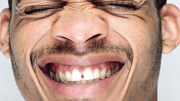 鹽城點陣激光祛口周紋醫(yī)生