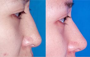 福建頂級整形醫(yī)院競逐第一：美貝爾、臺江、省立等五家實力匹敵