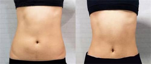 福州隆鼻整形醫(yī)生推薦匯總：專家升級，暢談口碑與擅長！