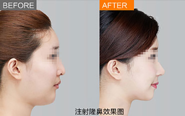 鄭州唇部整形醫(yī)院推薦：如何選擇合適的醫(yī)院？友友必看！