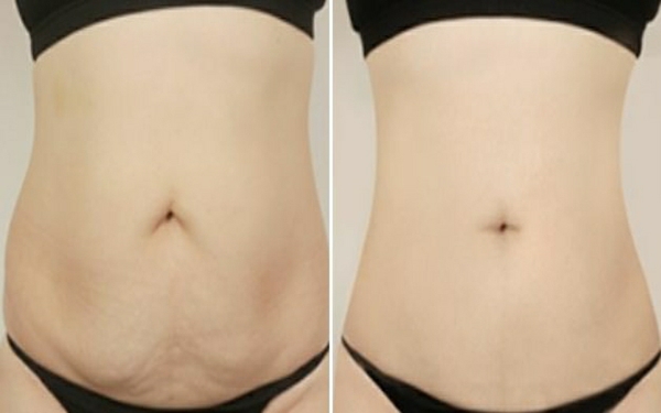 貴陽最受歡迎的雙眼皮手術機構大揭秘，你一定不能錯過！