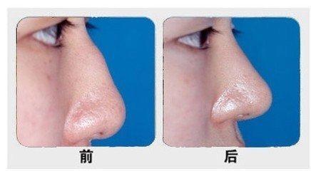 石家莊主要公立整形醫(yī)院排行榜！公辦醫(yī)療機(jī)構(gòu)最具實(shí)力！